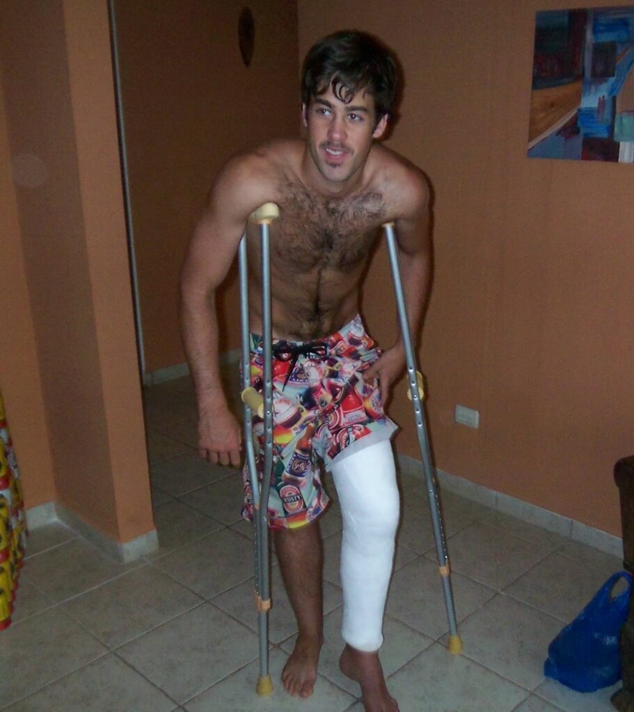Surfer on Crutches with Plaster Cast
